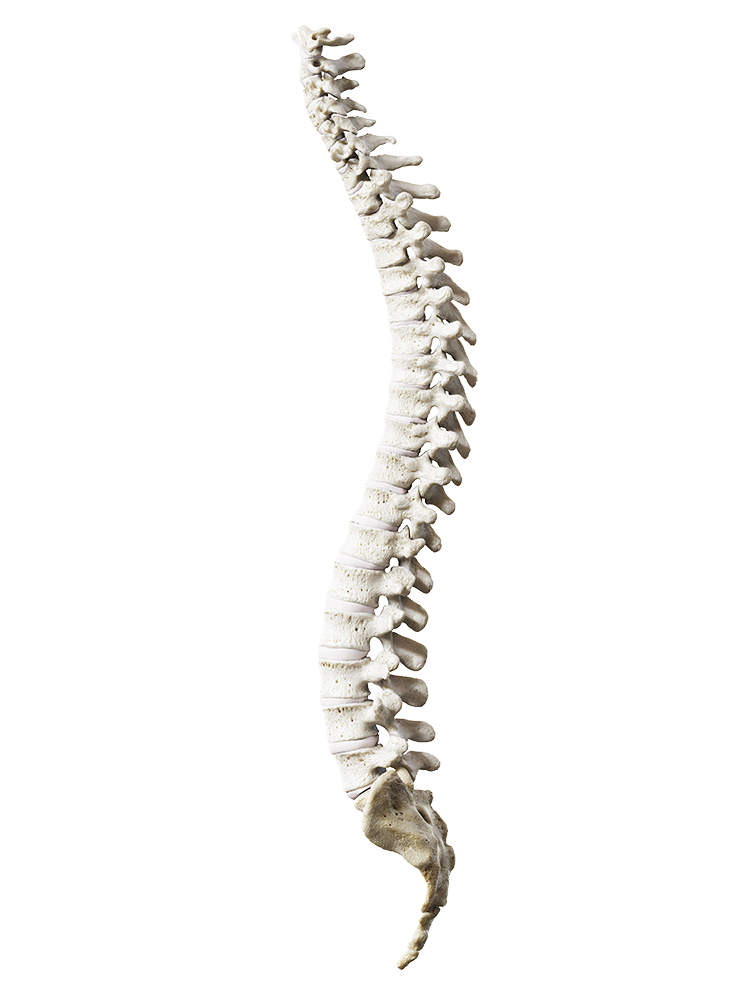 3D medical render of the human spine in side view, from the cervical curve through the lumbar curve and sacrum, showing where spinal stenosis narrows the canal